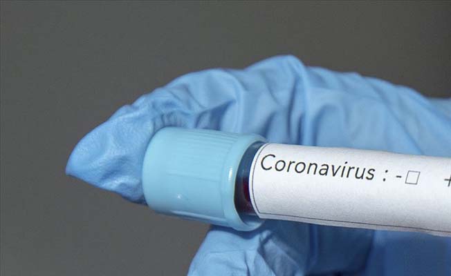 Çorum'da koronavirüs vakasında artış